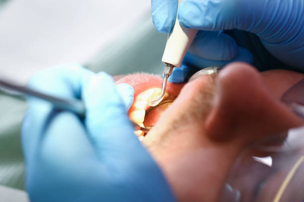 Best Emergency Tooth Extraction  in Clinton, IL
