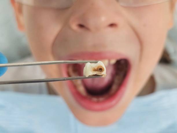 Best Emergency Dentist Open Today  in Clinton, IL