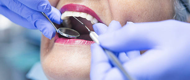 Best Knocked-Out Tooth Emergency  in Clinton, IL